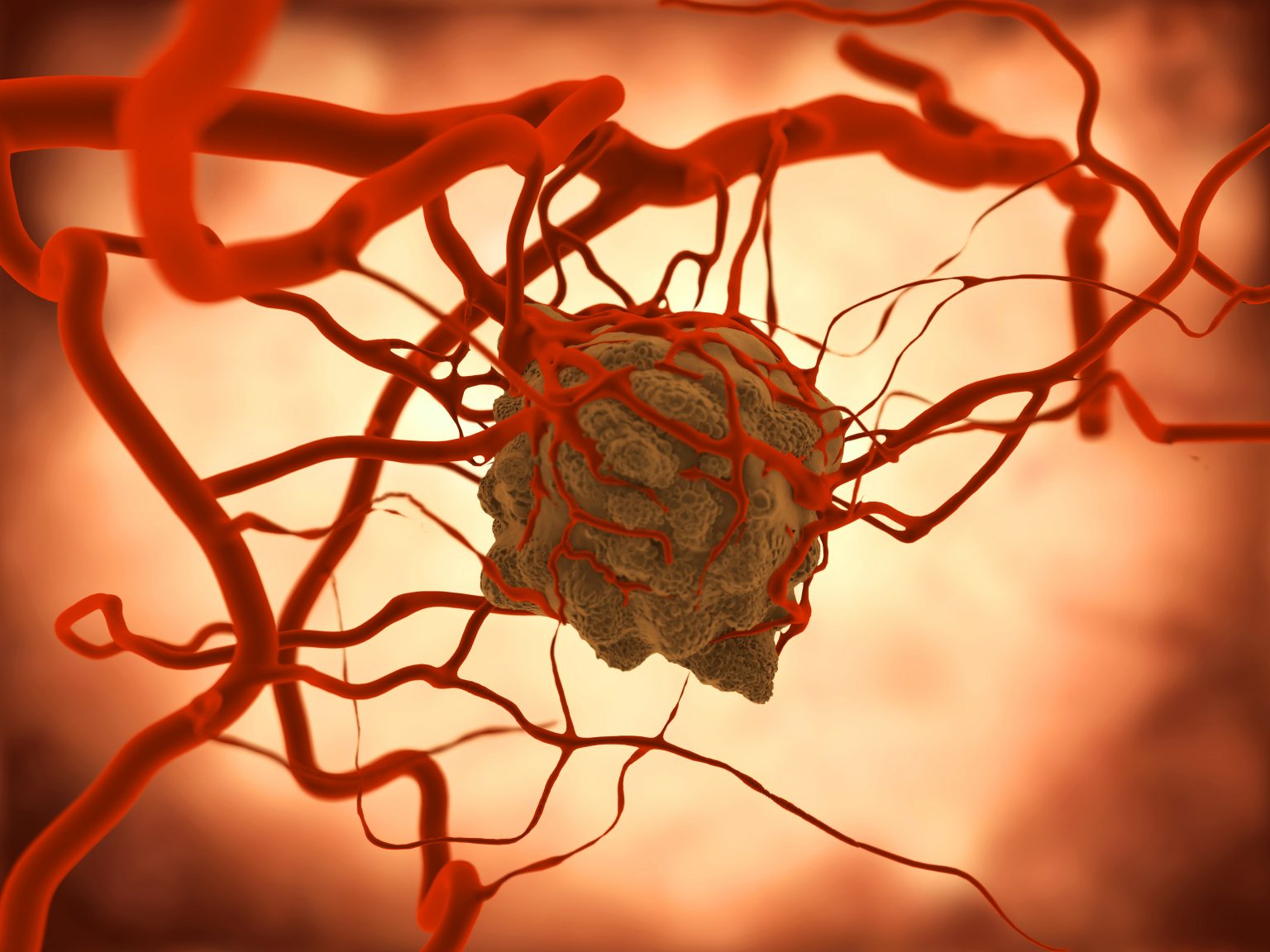 SpringWorks Therapeutics’ Promising Data for Orphan Drug, Nirogacestat