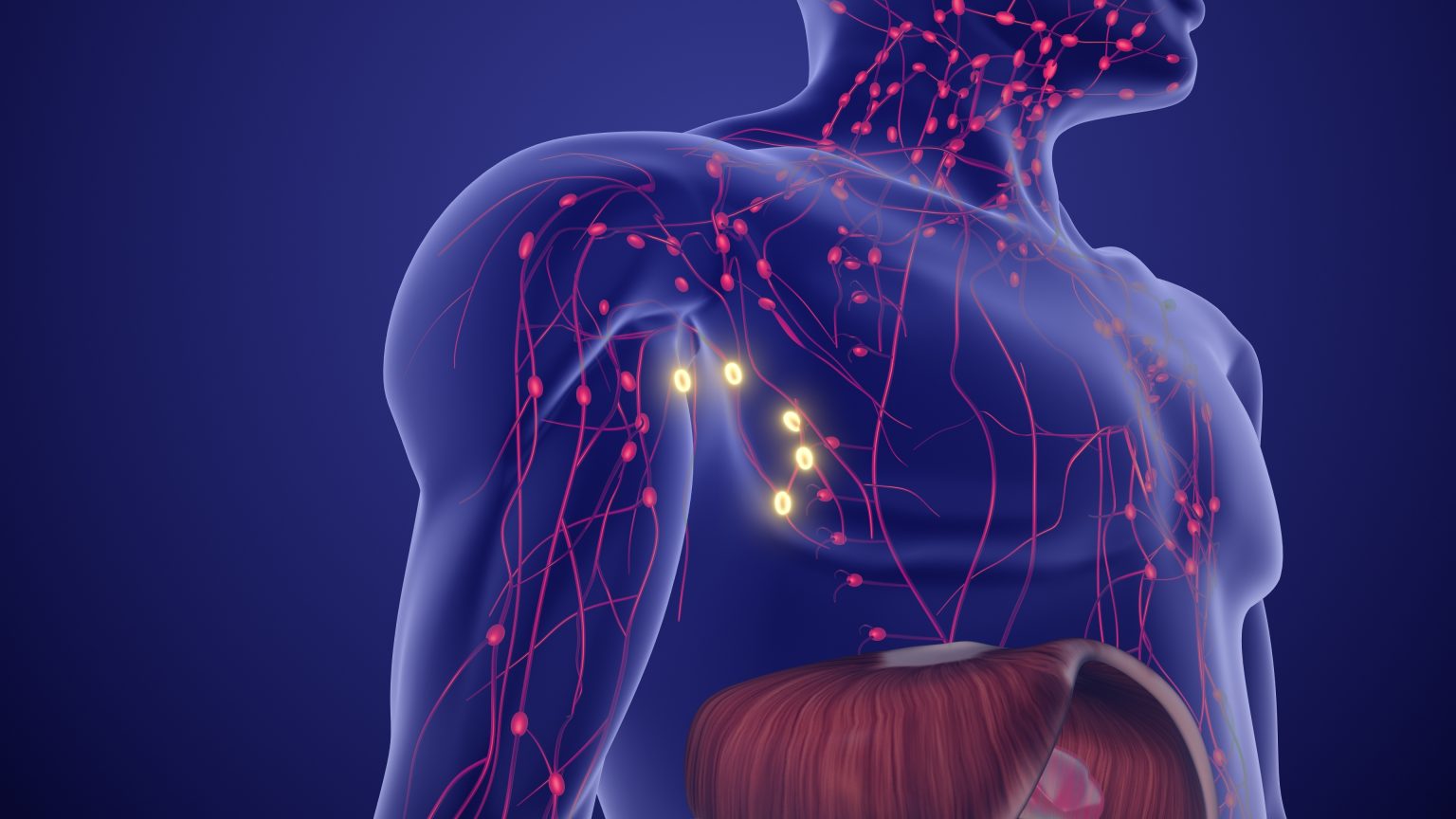 The Future of Oncology is Precise and Personalized