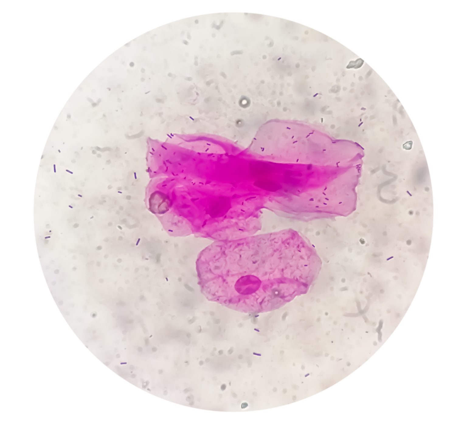 Reproductive Microbiome Therapeutics: Inside Freya Biosciences Gram-stained vaginal smear showing epithelial cells and Lactobacillus rods — reproductive microbiome therapeutics